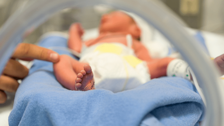 Unicef considera que más del 50% de muertes en recién nacidos podrían evitarse Unicef considera que más del 50% de muertes en recién nacidos podrían evitarse