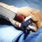 Mañana sábado se realizará jornada de captación de donantes de médula