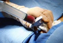 Mañana sábado se realizará jornada de captación de donantes de médula