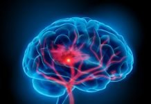 Científicos crean robot para tratar tumores y enfermedades cerebrovasculares.