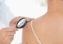 Impulsan “Campaña Solar 2019” para prevenir el cáncer de piel