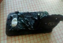 Joven argentino con quemaduras graves tras explotar su teléfono mientras dormía