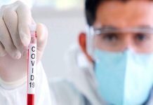 Más casos positivos de COVID19 en Itapúa