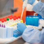 Pacto global donó 10.000 tests para detección del coronavirus