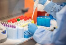 Pacto global donó 10.000 tests para detección del coronavirus