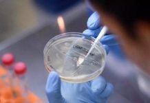 Covid-19: Salud reporta 44 muertes y 333 nuevos casos