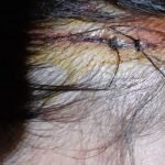 Mujer que evitó ser víctima de motochorros recibió brutal golpiza