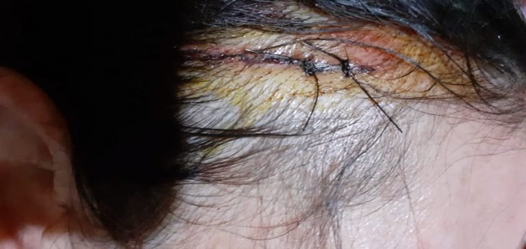 Mujer que evitó ser víctima de motochorros recibió brutal golpiza Mujer que evitó ser víctima de motochorros recibió brutal golpiza