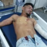 Con un bisturí hombre dejó herido a otro en Encarnación