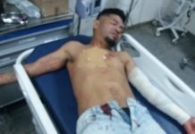 Con un bisturí hombre dejó herido a otro en Encarnación