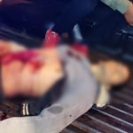 JOVEN FUE APUÑALADO Y SE DEBATE ENTRE LA VIDA Y LA MUERTE