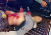 JOVEN FUE APUÑALADO Y SE DEBATE ENTRE LA VIDA Y LA MUERTE