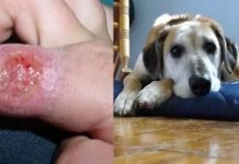 Detectan dos casos de Leishmaniasis humana en Itapúa