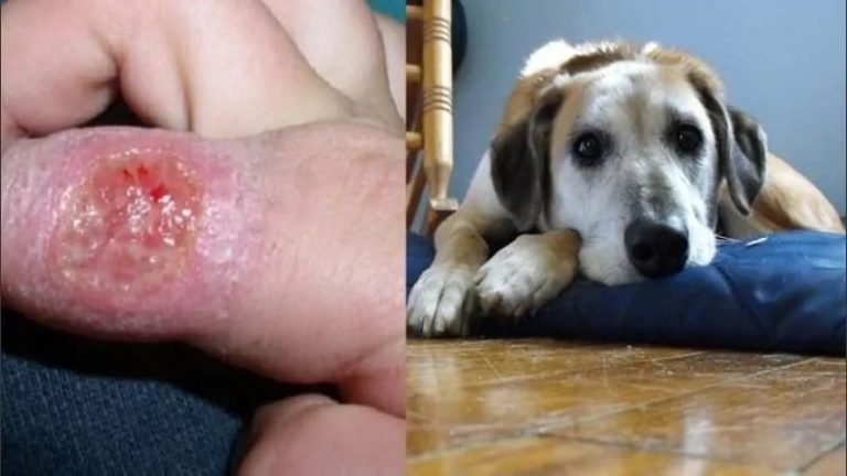 Detectan dos casos de Leishmaniasis humana en Itapúa
