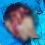 UNA MUJER CASI MATA A MACHETAZOS A SU PAREJA EN SAN PEDRO DEL PARANÁ