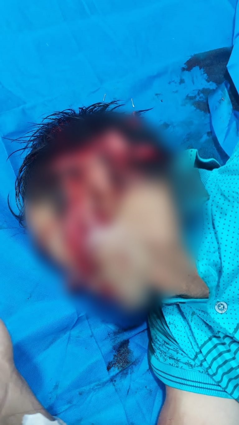 UNA MUJER CASI MATA A MACHETAZOS A SU PAREJA EN SAN PEDRO DEL PARANÁ