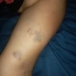 JOVEN HABRÍA GOLPEADO A SU MADRE, PORQUE SUP. SE OPONE A SU NUEVA RELACIÓN