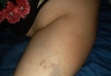 JOVEN HABRÍA GOLPEADO A SU MADRE, PORQUE SUP. SE OPONE A SU NUEVA RELACIÓN