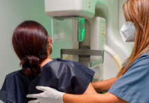 Salud habilita mamografías sin necesidad de orden médica para mujeres a partir de 40 años