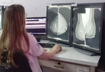 Instalación de nuevos mamógrafos genera récord de estudios para diagnóstico temprano de cáncer