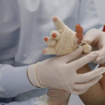 Niña pierde parte de su dedo tras manipular explosivo