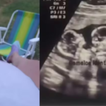 Caso robo de gemelos: en Clínicas confirman que joven no tuvo embarazo en el último mes