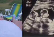 Caso robo de gemelos: en Clínicas confirman que joven no tuvo embarazo en el último mes