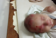 Rescatan a tres niños en estado de abandono: uno de ellos con la oreja agusanada