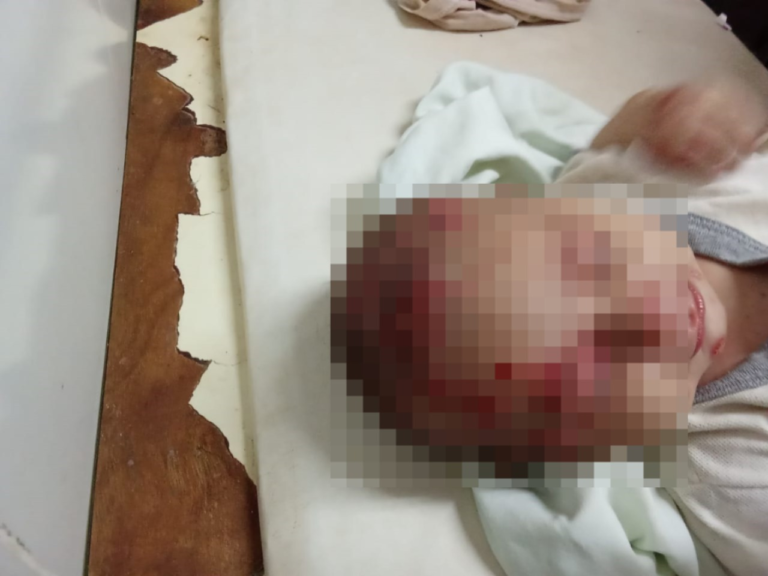 Rescatan a tres niños en estado de abandono: uno de ellos con la oreja agusanada