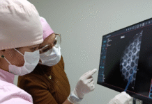 Hospital Distrital de Limpio realizó primera biopsia radioquirúrgica mamaria