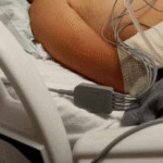 Madre clama ayuda para hijo accidentado con doble fractura de brazos y con un golpe en la cabezas