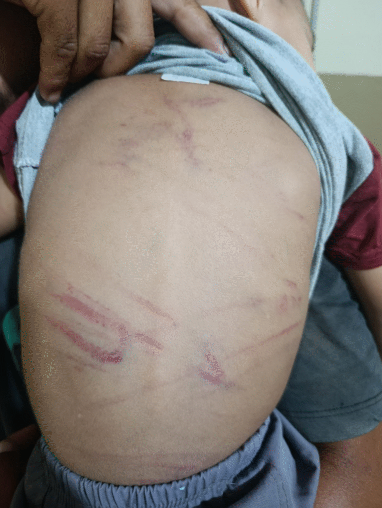 Detienen a mujer que habría agredido a su hijastro de 3 años Detienen a mujer que habría agredido a su hijastro de 3 años