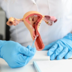 Cáncer del cuello uterino: importancia de la detección temprana y vacunación