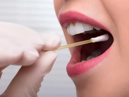 Invitan a sumarse al registro de donantes de médula ósea para ampliar las posibilidades de trasplante