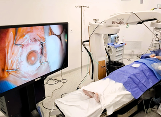 Más de 2.000 cirugías en centro de referencia a nivel país permiten que pacientes recuperen la visión